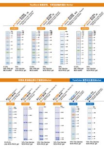 生工生物蛋白marker加強版限時促銷——優(yōu)質(zhì)生命科學產(chǎn)品與技術服務助力科研創(chuàng)新